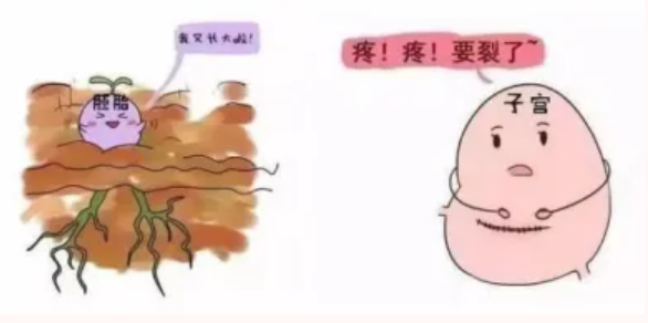 【康医科普】剖宫产后再妊娠 需警惕剖宫产瘢痕部位妊娠