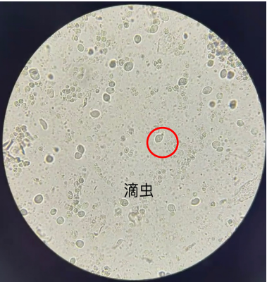 【康医科普】白带常规知多少？