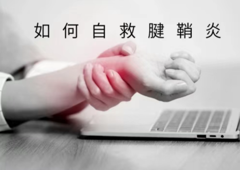 【康医科普】手指屈伸困难、关节肿大？别让腱鞘炎影响你的生活质量
